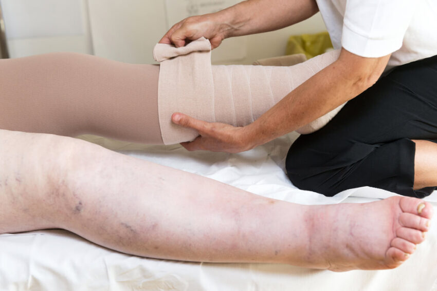 Lymphedema Therapy